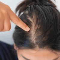 Thinning Crown or Part?